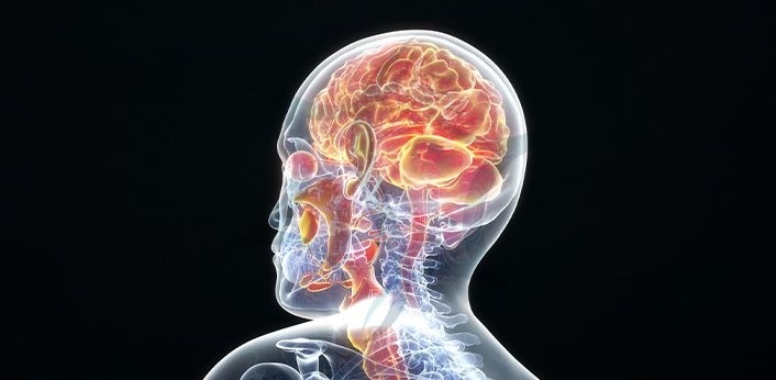 CONDROSSARCOMA, TUMOR GLÔMUS JUGULAR